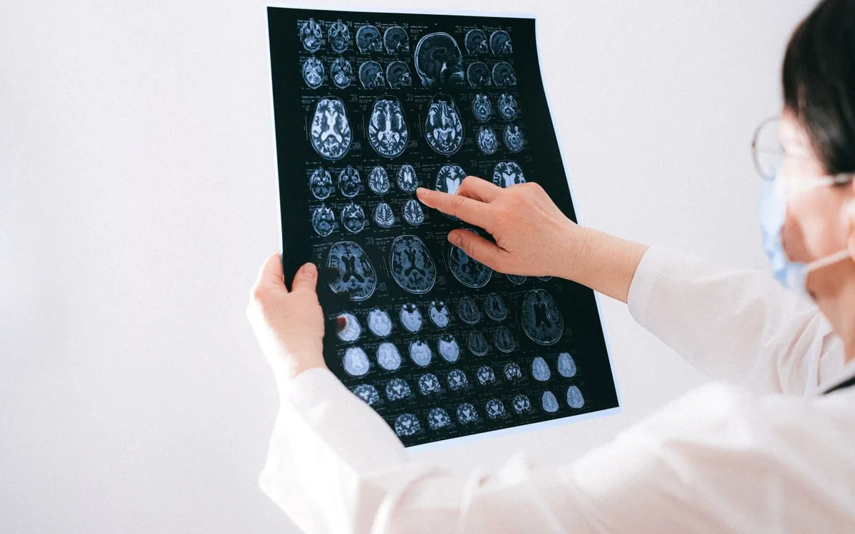 Neurology